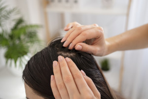 5 Cara Alami Bersihkan Kulit Kepala untuk Cegah Masalah Rambut